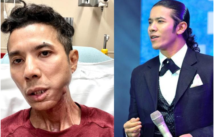 Kasim Hoàng Vũ đã qu:a đ:ời ở tuổi 46: “Tiết lộ hình ảnh cuối đời của anh, nhìn mà thấy thương”