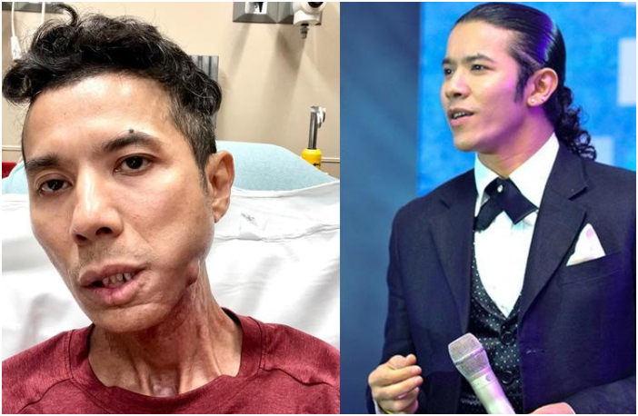 Kasim Hoàng Vũ đã qu:a đ:ời ở tuổi 46: “Tiết lộ hình ảnh cuối đời của anh, nhìn mà thấy thương”