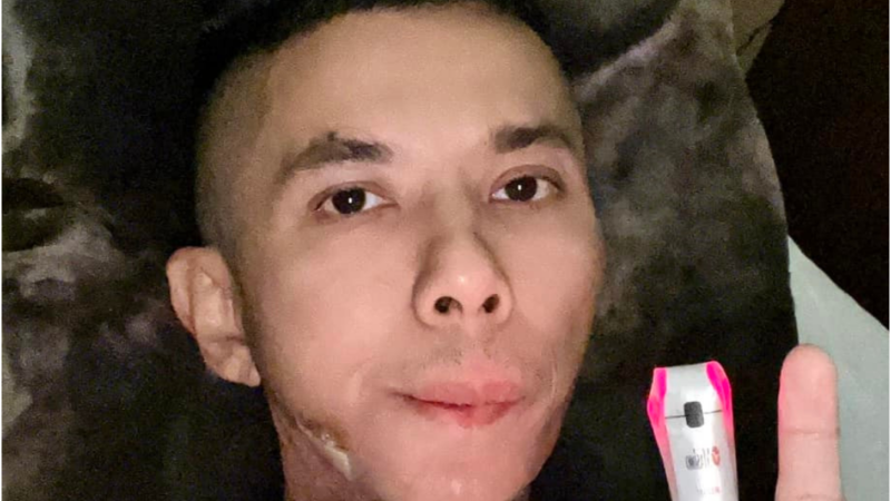 Rõ những ngày cuối đời của ca sĩ Kasim Hoàng Vũ: Khuôn mặt biế:n dạ:ng, tiề:u tụ:y, b:ế tắ:c vì chi phí chữa trị hàng tỷ đồng