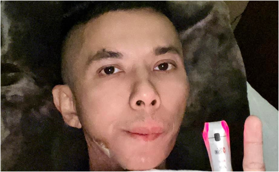 Rõ những ngày cuối đời của ca sĩ Kasim Hoàng Vũ: Khuôn mặt biế:n dạ:ng, tiề:u tụ:y, b:ế tắ:c vì chi phí chữa trị hàng tỷ đồng