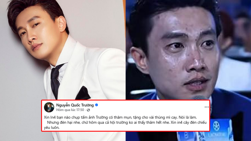 Bị soi cận da mặt mụn thâm trên sóng trực tiếp, Quốc Trường lập tức phủ nhận: Còn tuyên bố “treo thưởng” gây xôn xao!