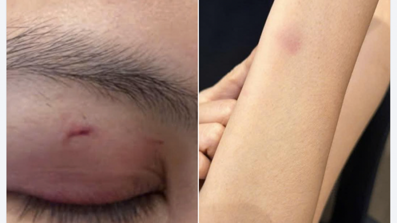 Vụ ca sĩ Trung Quân Idol bị tố hành hung nữ bác sĩ: Người tố cáo kể lại diễn biến, cho biết tình trạng sức khỏe của nạn nhân hiện chưa ổn định!