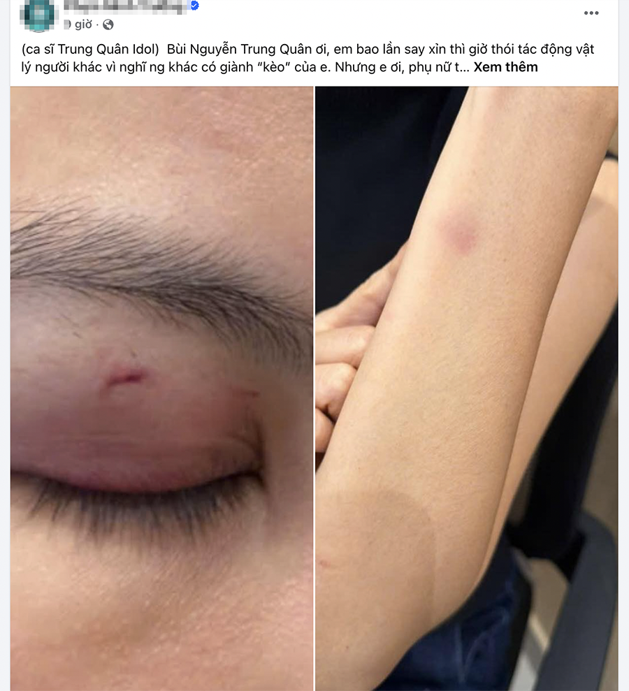 Vụ ca sĩ Trung Quân Idol bị tố hành hung nữ bác sĩ: Người tố cáo kể lại diễn biến, cho biết tình trạng sức khỏe của nạn nhân hiện chưa ổn định!